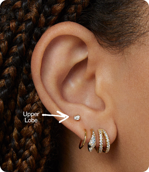 Upper Lobe