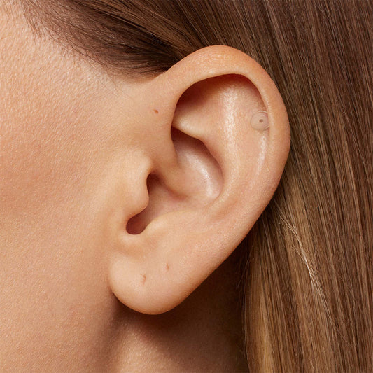 Yes, You Can Take Your Earring Out for Medical Procedures, But There's A Catch